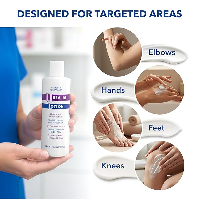 Urea 10% Lotion Cream for Extremely Dry, Rough and Scaly Skin, Intense Moisturizer and Gentle Exfoliator for Hands, Feet, Elbows and Knees Inc, 8 oz