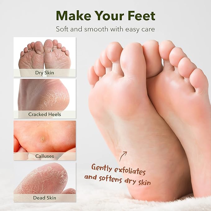 Purederm Shiny & Soft Foot Peeling Mask (3 pack) - For smooth and moist baby skin with Exfoliating peel off Calluses, Dry Skin, Cracked Heels - Men and Women