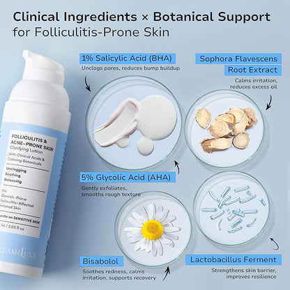 Folliculitis Acne Lotion for Body: Helps Reduce Itch, Redness, Body Acne, Bumps & Uneven Texture with Salicylic & Glycolic Acid + Botanicals - Gentle Care for Folliculitis-Prone Skin