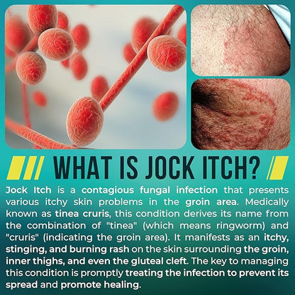 Jock Itch Cream | Extra Strength Antifungal Treatment for Groin & Inner Thighs | Relief for Itchy Skin, Jock Itch, Ringworm, Athlete’s Foot & Nail Fungus | Controls Odor & Removes Fungus | 120ml
